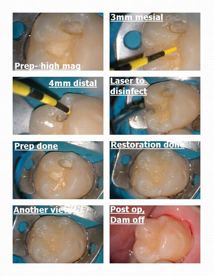 Pg 2 of microdental prep.jpg